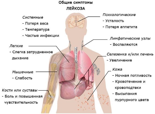 Лимфоциты повышены у ребенка в крови, нейрофилы понижены. О чем это говорит, норма по возрасту, таблица. Причины, симптомы