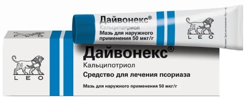 Псориаз. Симптомы и лечение в домашних условиях на голове, теле народными средствами, препараты, мази