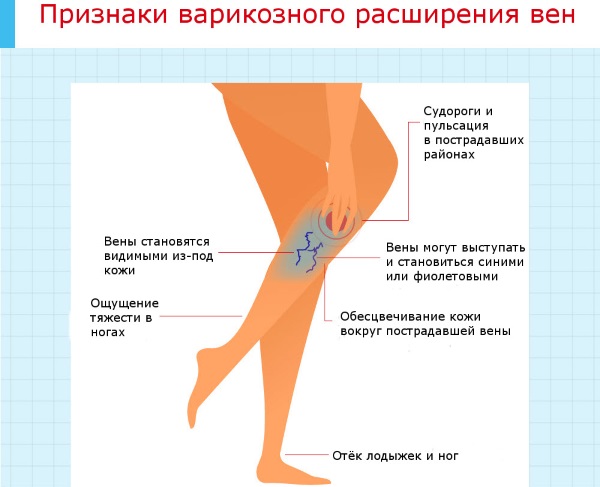 Мази для вен и сосудов на ногах недорогие, отечественные, при беременности. Список, цены