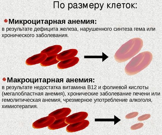 MCV в анализе крови. Что это такое, норма и отклонения у детей, женщин, мужчин