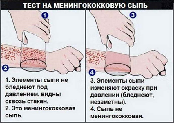 Вакцина от менингококковой инфекции. Название, какая лучше, когда делать, как переносится, цена