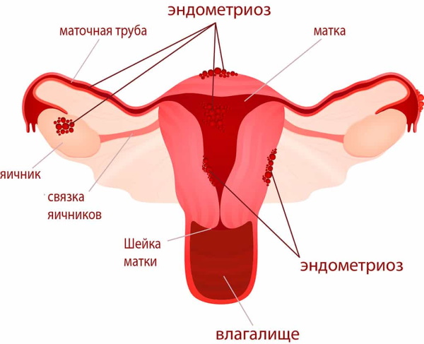 Депо-Провера (Depo-Provera). Отзывы женщин, инструкция по применению, дозировка, цена