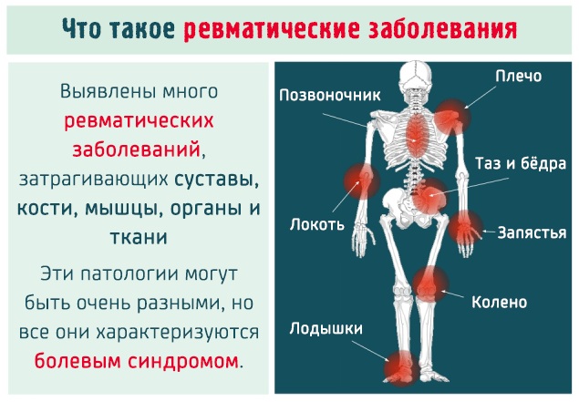 Воспаление (тендинит) сухожилий локтевого сустава. Лечение народными средствами, мазями