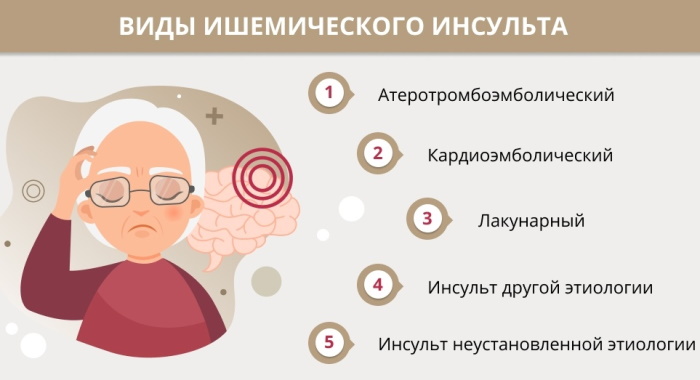 Микроинсульт у молодых девушек. Симптомы, возраст, лечение