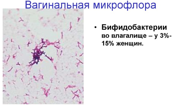 Микроскопическое исследование мазка у женщин. Расшифровка Инвитро, флора, лейкоциты