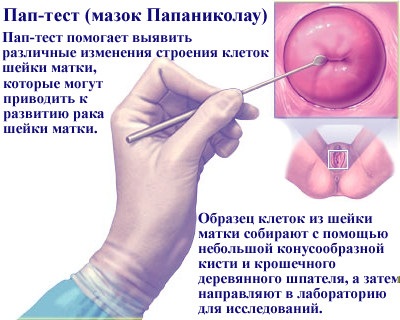 Микроскопическое исследование мазка у женщин. Расшифровка Инвитро, флора, лейкоциты