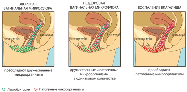 Микроскопическое исследование мазка у женщин. Расшифровка Инвитро, флора, лейкоциты