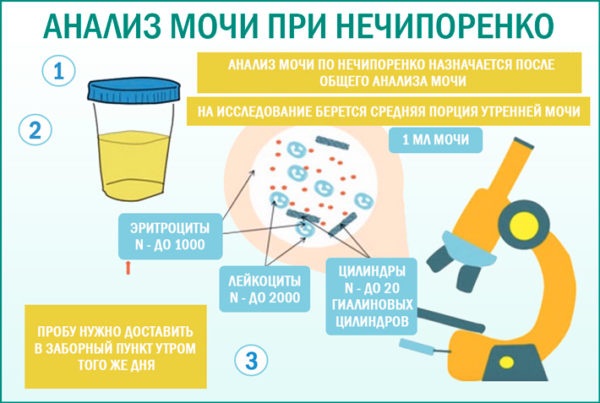 Инфекции мочевыводящих путей у женщин. Симптомы, лечение, препараты при беременности