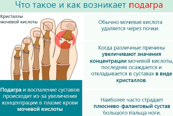 Тиазидные диуретики. Список препаратов, что это такое, механизм действия, противопоказания, побочные эффекты
