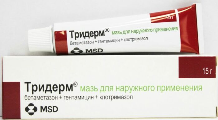 Монетовидная экзема. Что это такое, причины и лечение в домашних условиях