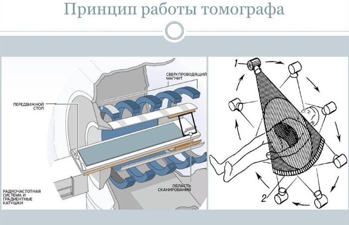 Вредно ли для здоровья МРТ? Противопоказания для детей, взрослых, беременных
