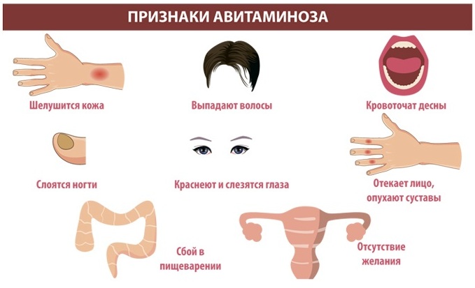 Витаминные капельницы для женщин. Цены, отзывы