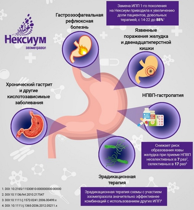 Нольпаза или Нексиум. Что лучше, разница, отзывы