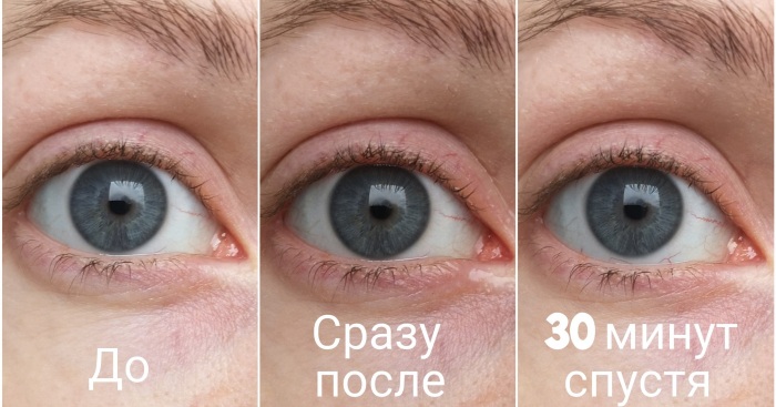 Офтагель (Oftagel) глазные капли. Цена, инструкция, аналоги дешевые