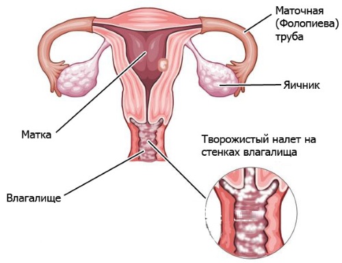 Клотримазол (Clotrimazolum) свечи при беременности 1-2-3 триместр. Инструкция по применению, аналоги