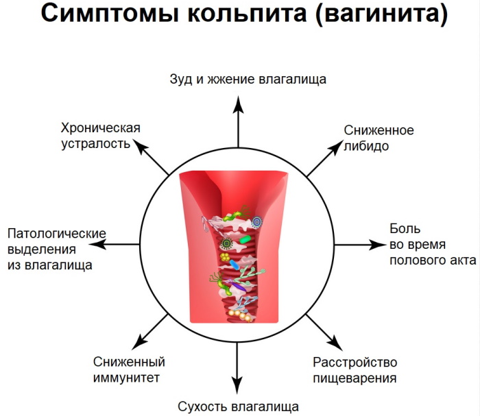 Острый вагинит. Что это, причины, симптомы, лечение
