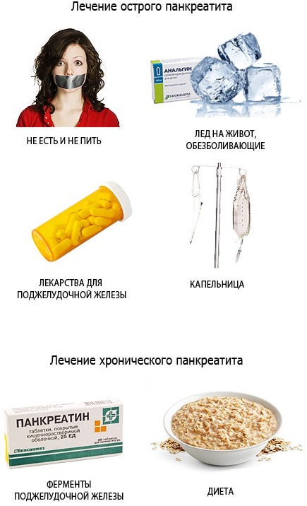 Панкреатит. Симптомы и лечение у взрослых. Народные средства, препараты, диета. Что можно, нельзя