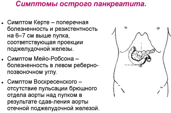 Панкреатит. Симптомы и лечение у взрослых. Народные средства, препараты, диета. Что можно, нельзя