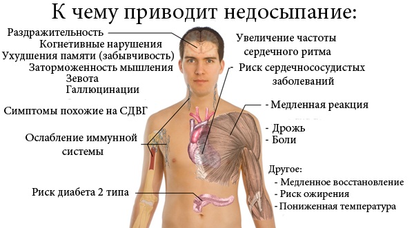 Переутомление. Признаки у взрослых, детей, что это, симптомы, лечение
