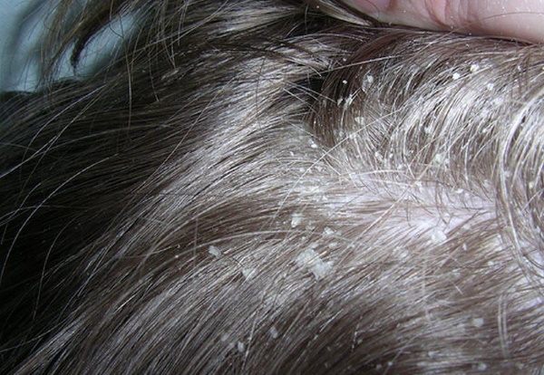PHYTO Phytophanere витамины для волос. Инструкция по применению, цена, отзывы