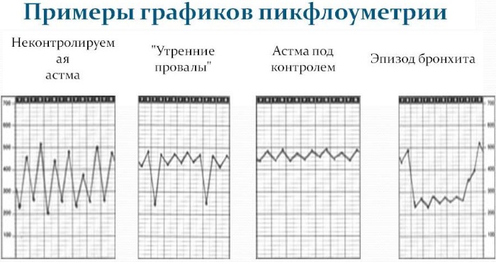 Синдромы при бронхиальной астме: ведущие основные, клинические у детей. Список
