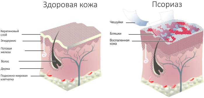 Дайвобет мазь. Инструкция по применению, цена, отзывы