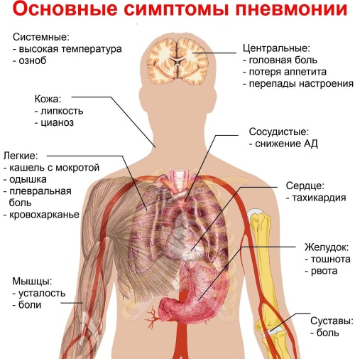 Бронхиолит. Симптомы и лечение у взрослых, что это, клинические рекомендации