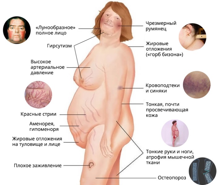 Показатели крови в норме у взрослых. Общего, биохимического, клинического, холестерин, билирубин, сахар. Расшифровка