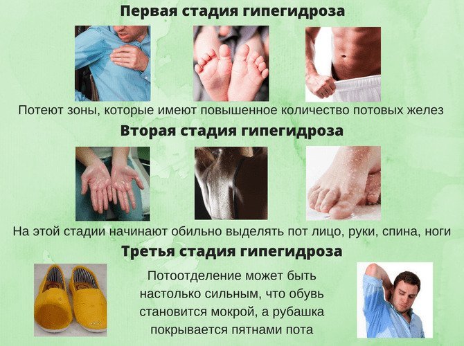 Потеют подмышки. Как избавиться, причины, что делать. Средства, рецепты, методы лечения