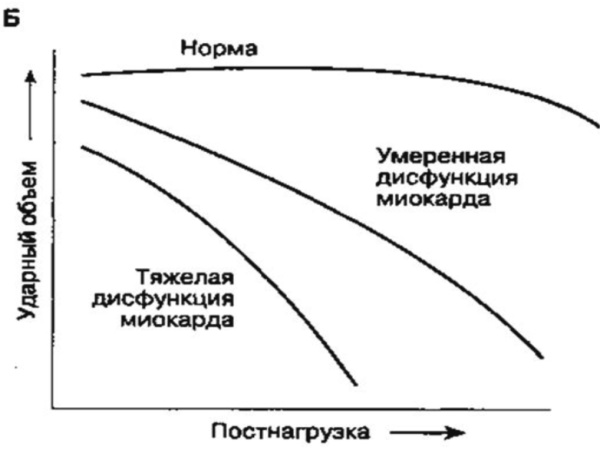 Преднагрузка и постнагрузка сердца. Что это такое, определение, лечение