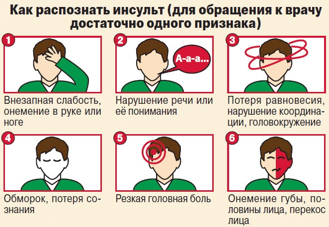 Микроинсульт у молодых девушек. Симптомы, возраст, лечение
