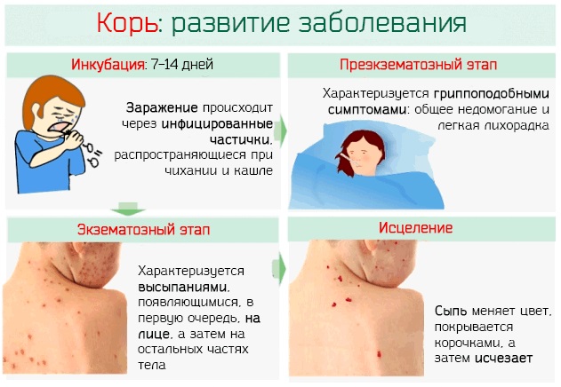 Прививка от кори, краснухи, паротита. График, как переносится, побочные эффекты