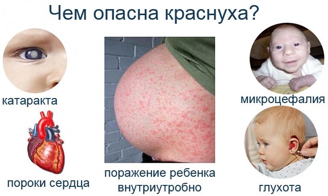Прививка от кори, краснухи, паротита. График, как переносится, побочные эффекты