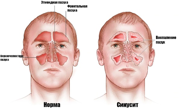 Масло персика для носа и горла детям и взрослым. Отзывы