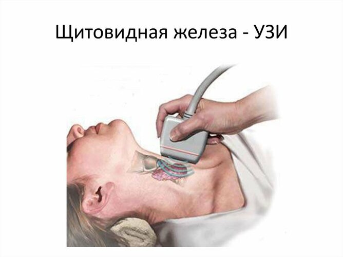 Пропадает голос. Причины, если горло не болит, как лечить