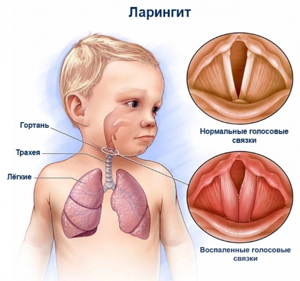 Кипферон (Kipferon) свечи для детей. Отзывы, инструкция, аналоги, цена