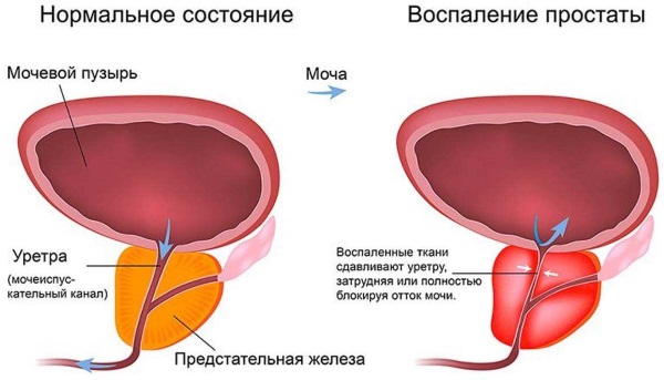 Бруснивер. Инструкция по применению сбор, чай, таблетки. Цена, аналоги