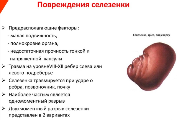 Разрыв селезенки. Симптомы у взрослых, последствия, степень тяжести, вред, диагностика