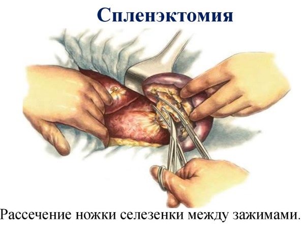 Rdw в анализе крови. Что это такое, норма, расшифровка