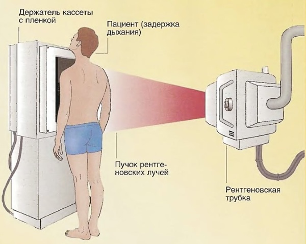 Рентгенография ОГК. Что это такое в 2-х проекциях, прямой проекции, подготовка, расшифровка, цена