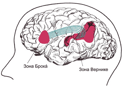 Сенсорная алалия у детей. Признаки и лечение, что это такое, прогноз