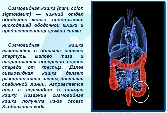 Сигмовидная кишка. Где находится и как болит, симптомы, заболевания, лечение и операция по удалению