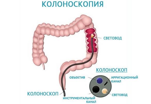 Сигмовидная кишка. Где находится и как болит, симптомы, заболевания, лечение и операция по удалению