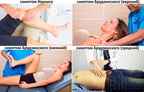 Симптом Кернига и Брудзинского при менингите, ОНМК, паркинсоне, инсульте. Что это такое, как проверить