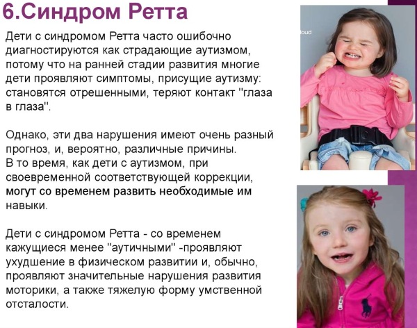 Синдром Ретта у девочек, детей. Что это такое, симптомы, лечение, причины