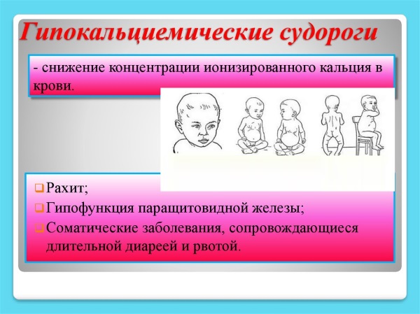 Судороги у детей при температуре. Причины, первая помощь, последствия спазмофилии, фебрильные