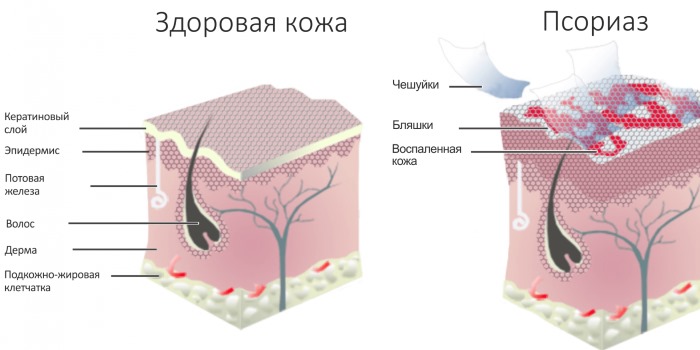 Сыпь на теле у ребенка. Фото с пояснениями: в виде прыщиков, мелкая, чешется, красная, без температуры, зуд, аллергическая. Что это может быть