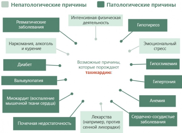 Синусовая тахикардия сердца. Что это такое, симптомы, как лечить у женщин, детей