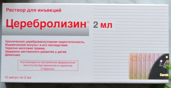 Микроинсульт у молодых девушек. Симптомы, возраст, лечение