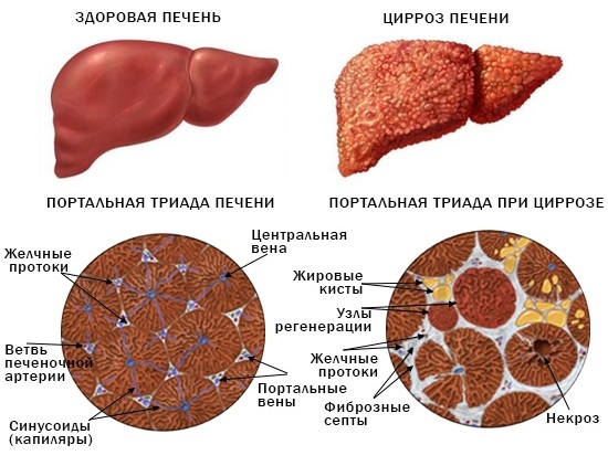 Густая желчь. Причины и лечение, симптомы, что делать, лекарства, диета